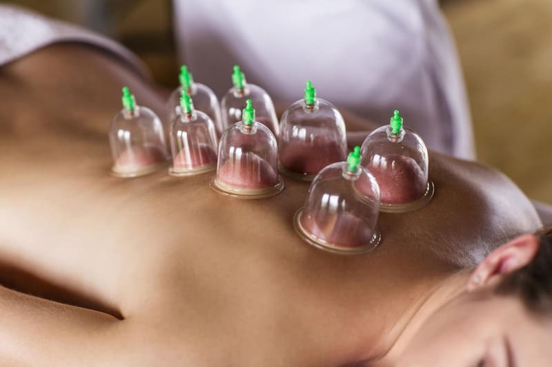 Cupping massage